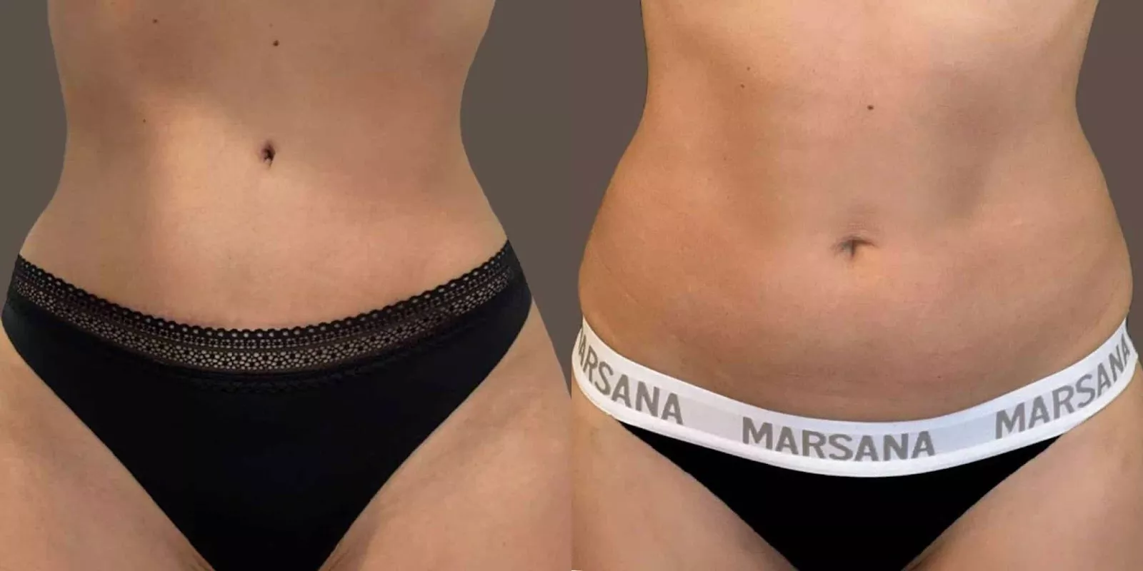 AD_4nXemdA0ZEUOi2j2vdE-QIdkOKJzPeLeOLrBjU41FTyV5Sx8S16aP3V6l6dowZwKVKzI9MkXVZv2aVQs4fPTl4JndCVcd2f33efFssEAnQFp84ft_HXd8S2KmQJoGgCPw8zbWAvGs_A?key=UyJZkTkcmUNsarxFlnuaPw